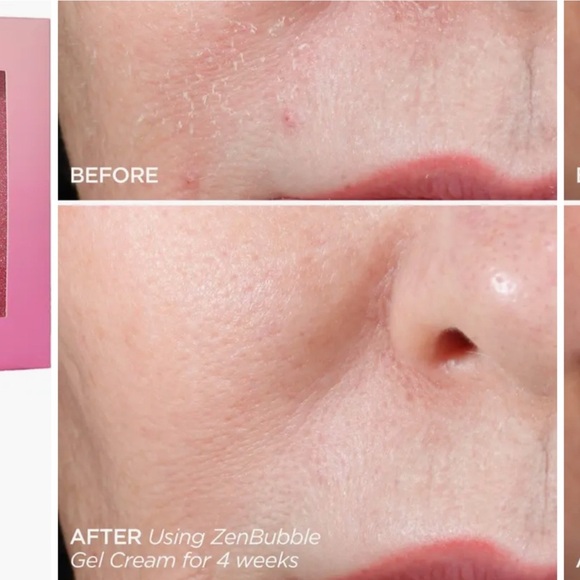 BeautyBio 5-Star Faves Skincare Set NIB - Picture 4 of 4